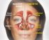 CARA MENGOBATI ORANG SAKIT SINUSITIS