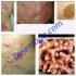 RAMUAN HERBAL JAMUR KULIT